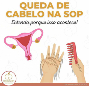 queda de cabelo na sop
