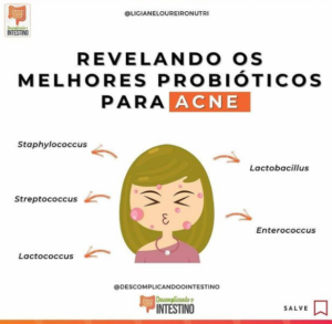 Revelando os Melhores Probióticos para Acne