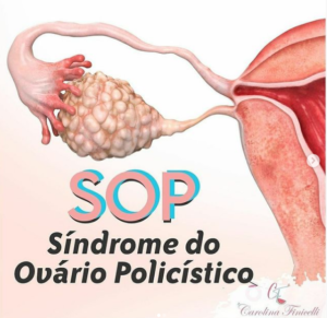 Primeiramente O QUE É SOP?