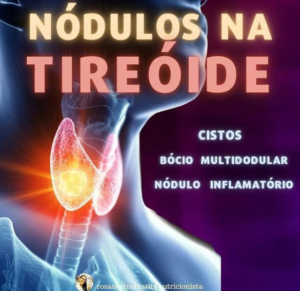 nodulos na tireoide