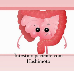 Intestino no Paciente com Hashimoto