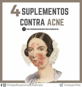 4 suplementos contra acne