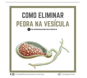 Como Eliminar Pedra na Vesícula