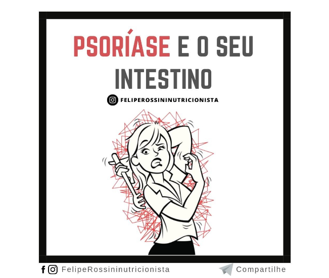 Psoríase e o seu Intestino