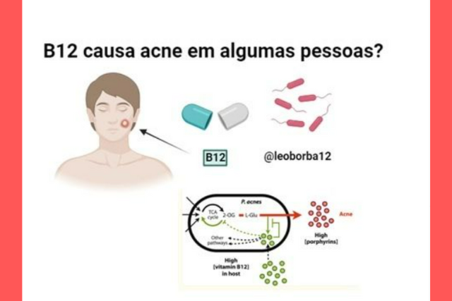 B12 Causa Acne em Algumas Pessoas