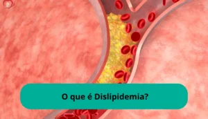 O que é Dislipidemia?
