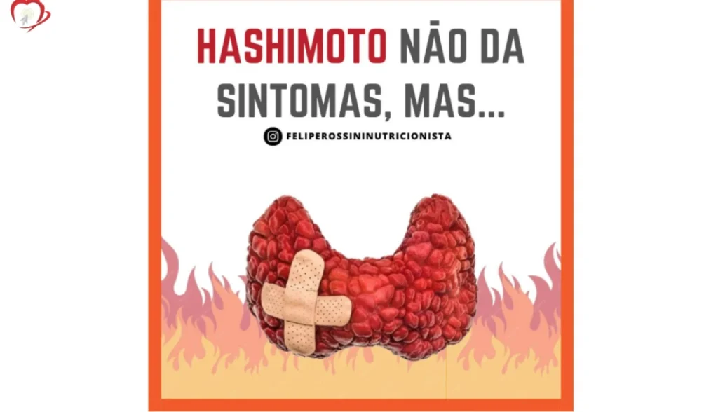 Hashimoto não dá Sintomas, mas...